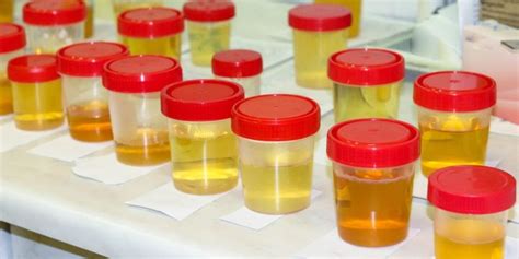 In this. . I mixed synthetic urine with real urine